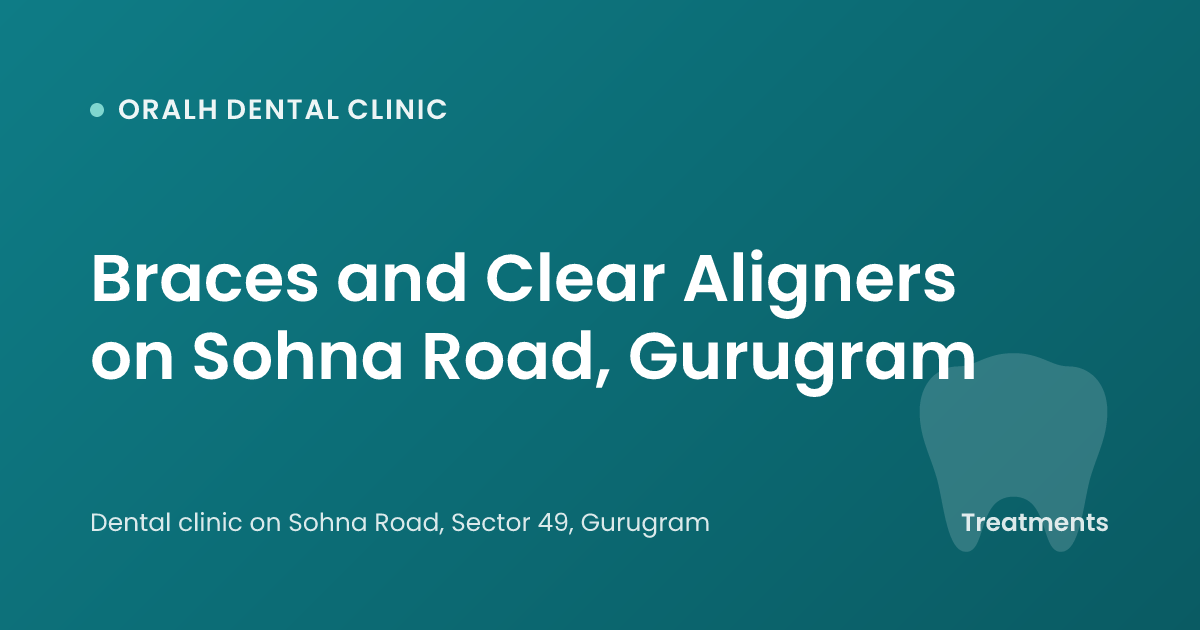 Braces and Clear Aligners on Sohna Road, Gurugram