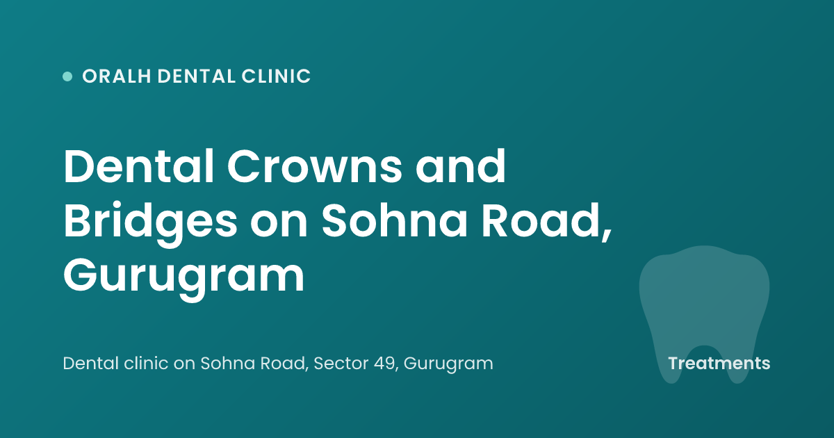 Dental Crowns and Bridges on Sohna Road, Gurugram