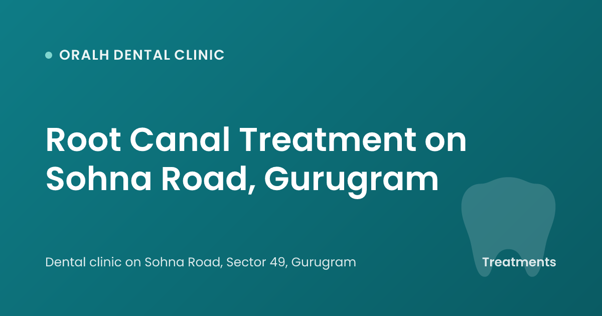 Root Canal Treatment on Sohna Road, Gurugram