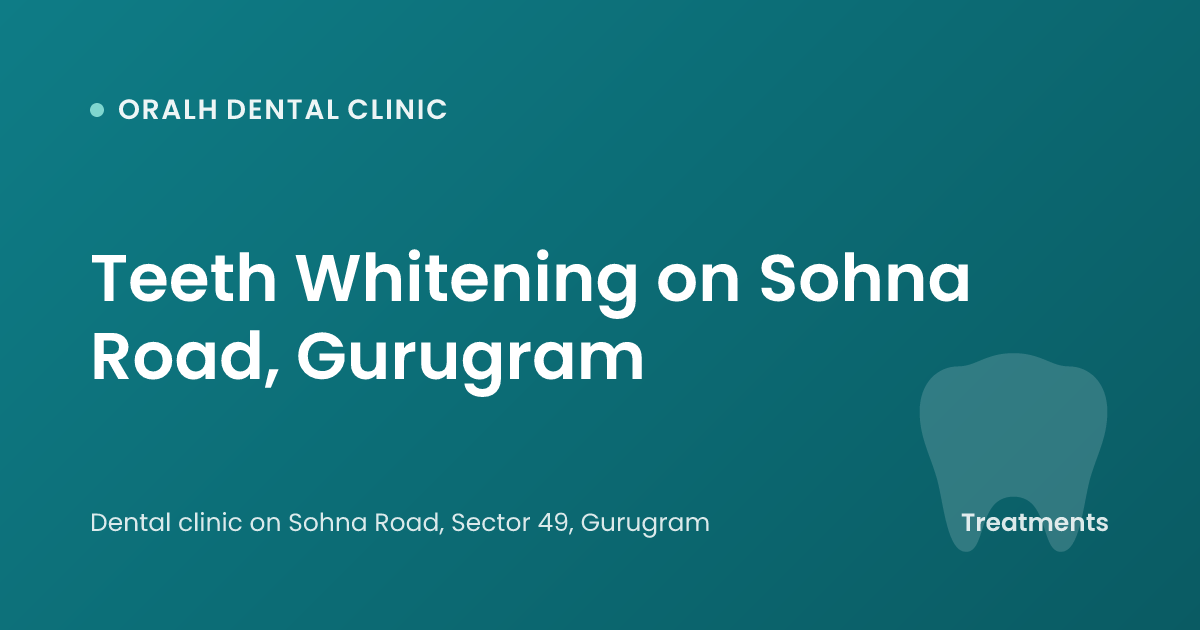 Teeth Whitening on Sohna Road, Gurugram