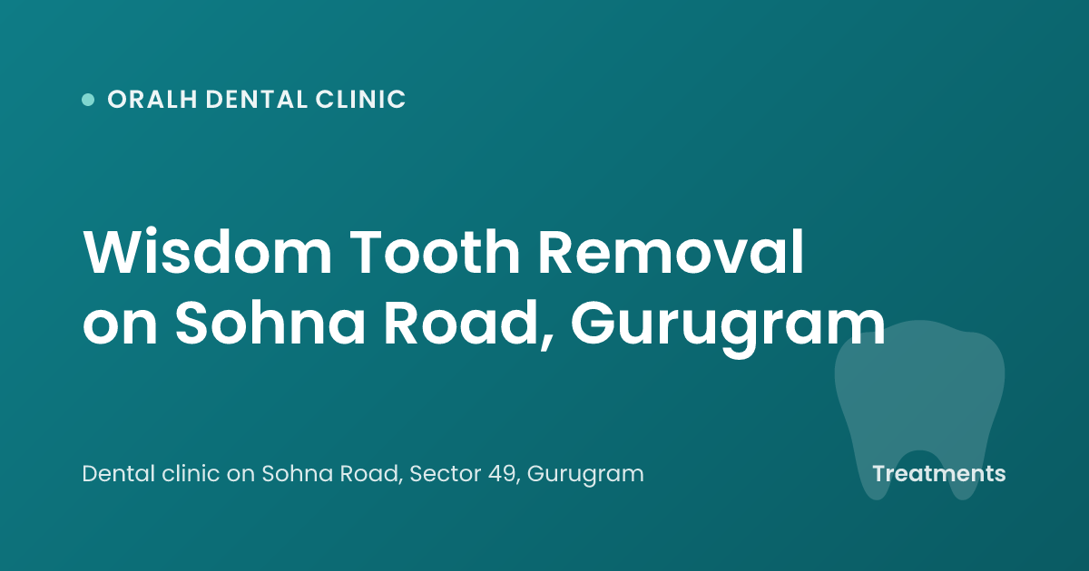 Wisdom Tooth Removal on Sohna Road, Gurugram