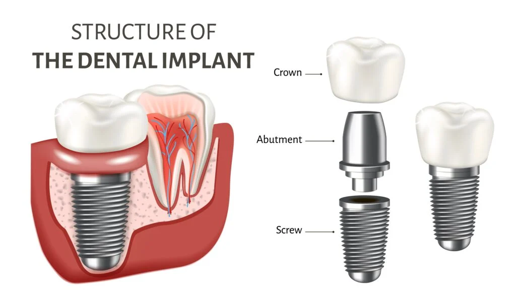 dental image